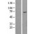 Western Blot: ABCE1 Lysate [NBL1-07182] - Western Blot experiments.  Left-Control; Right -Over-expression Lysate for ABCE1.